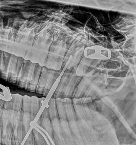 Minimally invasive transbuccal screw extraction